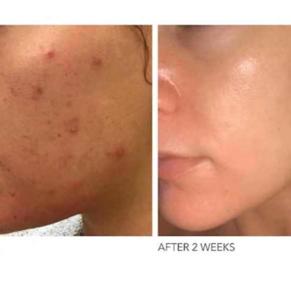 πDr David Gross - Alpha Beta π - Picture 4 of 8